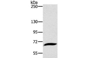 Western Blot analysis of Mouse liver tissue using CD42b Polyclonal Antibody at dilution of 1:800 (CD42b anticorps)