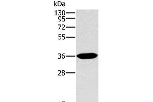Western Blot analysis of Human fetal intestine tissue using ITLN1 Polyclonal Antibody at dilution of 1:400 (ITLN1/Omentin anticorps)