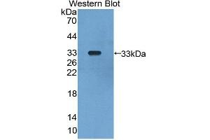 Western blot analysis of the recombinant protein. (GLMN anticorps  (AA 294-549))