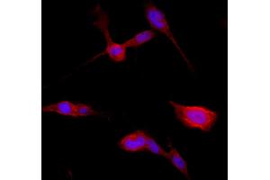 Confocal immunofluorescence - anti-Catenin beta1 Ab in BEAS-2B cells at 1/250 dilution, cells were fixed with 4% of PFA,
