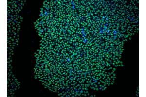 Immunoflourescent staining of Sox2 in human embryonic stem (ES) cells.