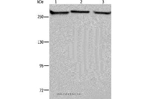 Western blot analysis of PC3, NIH/3T3 and HUVEB cell, using FLNA Polyclonal Antibody at dilution of 1:1100