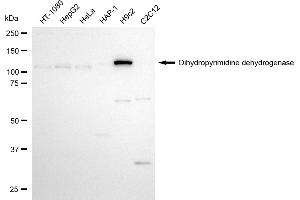 Western blotting analysis using dihydropyrimidine dehydrogenase antibody (ABIN7798341). (Recombinant DPYD anticorps)