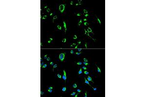 Immunofluorescence analysis of MCF-7 cells using APOBEC3G antibody. (APOBEC3G anticorps)