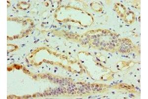 Immunohistochemistry of paraffin-embedded human kidney tissue using ABIN7147891 at dilution of 1:100 (CLDN14 anticorps  (AA 140-239))