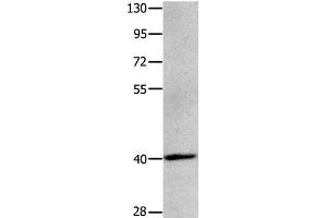 Western Blot analysis of Human brain glioma tissue using MAGEB4 Polyclonal Antibody at dilution of 1:550 (MAGEB4 anticorps)