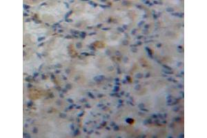 Used in DAB staining on fromalin fixed paraffin-embedded stomach tissue (FABP5 anticorps  (AA 2-135))