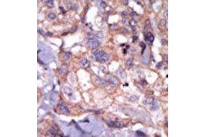 Image no. 1 for anti-TXK tyrosine Kinase (TXK) (N-Term) antibody (ABIN359999)