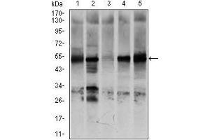 Western blot analysis using NR6A1 mouse mAb against K562 (1), NTERA-2 (2), HEK293 (3), HUVE-12 (4), and HeLa (5) cell lysate.