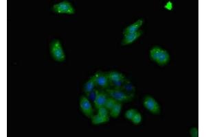 Immunofluorescent analysis of HepG2 cells using ABIN7143372 at dilution of 1:100 and Alexa Fluor 488-congugated AffiniPure Goat Anti-Rabbit IgG(H+L) (GPR124 anticorps  (AA 1069-1338))