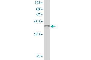 Western Blot detection against Immunogen (37.