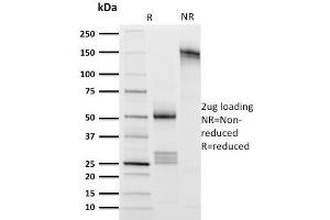 SDS-PAGE Analysis Purified CD8 Mouse Monoclonal Antibody (UCHT4). (CD8 alpha anticorps)