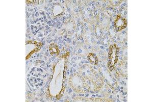 Immunohistochemistry of paraffin-embedded rat kidney using KRT20 Antibody. (KRT20 anticorps  (AA 245-424))