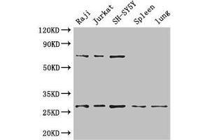 Western Blot Positive WB detected in: Raji whole cell lysate, Jurkat whole cell lysate, SH-SY5Y whole cell lysate, Mouse spleen tissue, Mouse lung tissue All lanes: YWHAZ antibody at 3. (14-3-3 zeta anticorps  (AA 133-212))