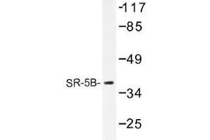 Image no. 1 for anti-5-Hydroxytryptamine (serotonin) Receptor 5B (HTR5B) antibody (ABIN317728)