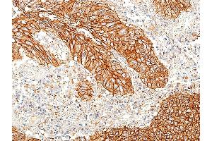 Immunohistochemistry (IHC) image for anti-Cadherin 1, Type 1, E-Cadherin (Epithelial) (CDH1) (AA 155-707) antibody (ABIN7454024)