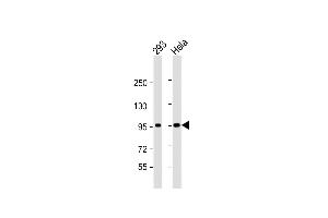 All lanes : Anti-CTNNB1 Antibody (C-term) at 1:1000 dilution Lane 1: 293 whole cell lysate Lane 2: Hela whole cell lysate Lysates/proteins at 20 μg per lane.