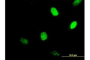 Immunofluorescence of purified MaxPab antibody to MGMT on HeLa cell. (MGMT anticorps  (AA 1-207))