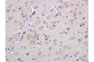 Formalin-fixed and paraffin embedded rat brain labeled with Anti-MOBP Polyclonal Antibody, Unconjugated  at 1:200 followed by conjugation to the secondary antibody and DAB staining. (MOBP anticorps  (AA 7-90))
