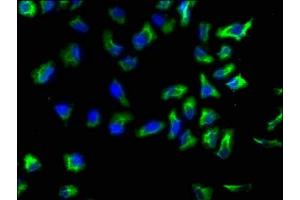 Immunofluorescence staining of Hela cells with ABIN7143811 at 1:133, counter-stained with DAPI. (ACTN1 anticorps  (AA 1-204))
