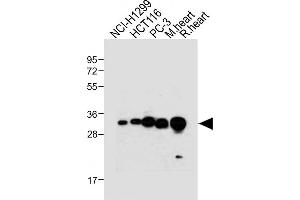 All lanes : Anti-VDAC2 Antibody (N-term) at 1:4000 dilution Lane 1: NCI- whole cell lysate Lane 2: HC whole cell lysate Lane 3: PC-3 whole cell lysate Lane 4: Mouse heart tissue lysate Lane 5: Rat heart tissue lysate Lysates/proteins at 20 μg per lane.