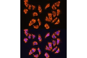 Immunofluorescence analysis of U2OS cells using alpha Sarcoglycan (alpha Sarcoglycan (SGCA)) Rabbit pAb (ABIN1682687, ABIN5664644, ABIN5664646 and ABIN6220497) at dilution of 1:100. (SGCA anticorps  (AA 60-290))