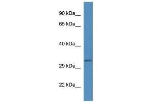 Western Blot showing Bend6 antibody used at a concentration of 1.