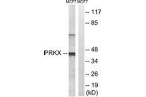 Western Blotting (WB) image for anti-Protein Kinase, X-Linked (PRKX) (AA 251-300) antibody (ABIN2890617)