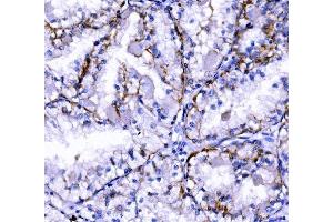 IHC analysis of Claudin 7/CLDN-7 using anti-Claudin 7/CLDN-7 antibody (ABIN7602665).