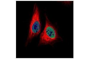 ICC/IF Image Confocal immunofluorescence analysis (Olympus FV10i) of paraformaldehyde-fixed HeLa, using TEAD4, antibody (Green) at 1:500 dilution.
