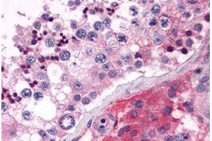 Anti-ELOVL5 antibody  ABIN1048538 IHC staining of human testis. (ELOVL5 anticorps  (C-Term))