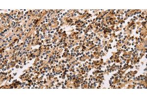 Immunohistochemistry of paraffin-embedded Human tonsil using PPP1CB Polyclonal Antibody at dilution of 1:30 (PPP1CB anticorps)
