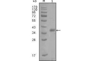 Western blot analysis using FABP4 mouse mAb against truncated Trx-FABP4 recombinant protein (1).