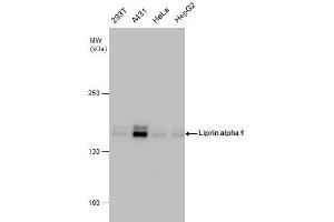 WB Image Liprin alpha 1 antibody detects Liprin alpha 1 protein by western blot analysis.