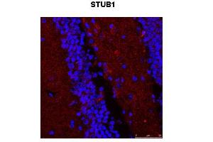 Immunohistochemistry (IHC) image for anti-STIP1 Homology and U-Box Containing Protein 1 (STUB1) (N-Term) antibody (ABIN2774916) (STUB1 anticorps  (N-Term))