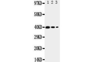 Western Blotting (WB) image for anti-Translocation Associated Membrane Protein 2 (TRAM2) (AA 309-325), (C-Term) antibody (ABIN3044050) (TRAM2 anticorps  (C-Term))