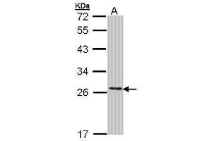 WB Image Sample (30 ug of whole cell lysate) A: Molt-4 , 12% SDS PAGE antibody diluted at 1:1000 (COMT anticorps)