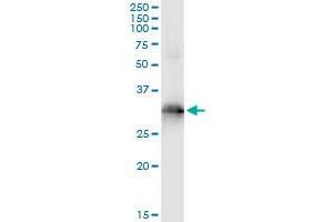 Immunoprecipitation of HOXB9 transfected lysate using anti-HOXB9 monoclonal antibody and Protein A Magnetic Bead , and immunoblotted with HOXB9 MaxPab rabbit polyclonal antibody. (HOXB9 anticorps  (AA 65-163))