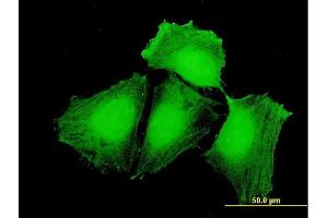 Immunofluorescence of purified MaxPab antibody to CEP57 on HeLa cell.