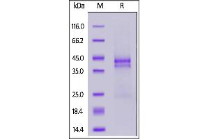 Human CTGF, His Tag on  under reducing (R) condition. (CTGF Protein (AA 27-349) (His tag))