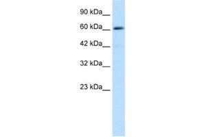 Western Blotting (WB) image for anti-Zinc Finger and BTB Domain Containing 45 (ZBTB45) antibody (ABIN2460149) (ZBTB45 anticorps)