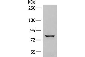 Western blot analysis of Human bladder transitional cell carcinoma grade 2-3 tissue lysate using TTC12 Polyclonal Antibody at dilution of 1:300 (TTC12 anticorps)
