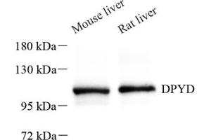 Western blot analysis of DPD (ABIN7073735),at dilution of 1: 600 (DPYD anticorps)