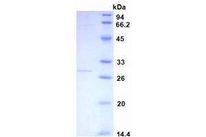SDS-PAGE analysis of recombinant Human CRP. (CRP Protéine)