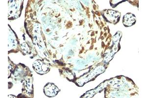 Formalin-fixed, paraffin-embedded human placenta stained with TIMP3 Rabbit PAb.