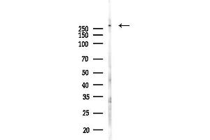 Western blot analysis of lysates from Hela cells(LPS, 4h treatment), using Piezo1 Antibody at 1/1000 dilution.