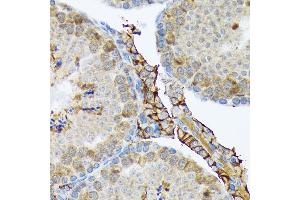 Immunohistochemistry of paraffin-embedded mouse testis using PLTP Rabbit mAb (ABIN7269357) at dilution of 1:100 (40x lens).