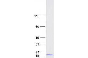 Validation with Western Blot