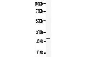 Anti-CNTF Picoband antibody,  All lanes: Anti-CNTF at 0.