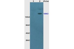 Lane 1: rat brain lysates Lane 2: rat kidney lysates probed with Anti MCR Polyclonal Antibody, Unconjugated  at 1:200 in 4˚C.